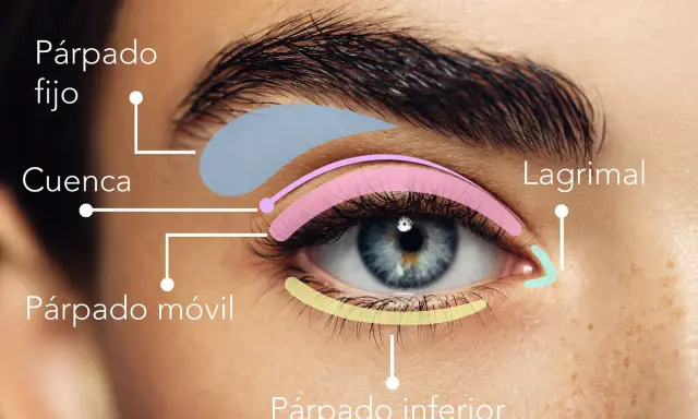 Diagrama de ojo con áreas coloreadas: párpado fijo, cuenca, párpado móvil, lagrimal y párpado inferior.