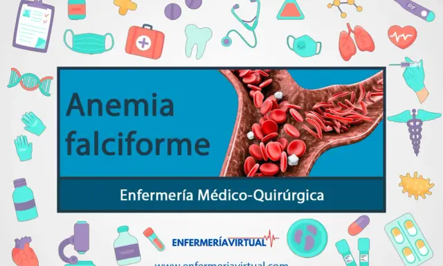 Anemia falciforme: glóbulos rojos con forma de hoz bloquean el flujo sanguíneo. Ilustración médica con iconos de salud.