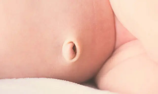 Primer plano de la piel de un bebé, mostrando un ombligo con una leve hernia umbilical.