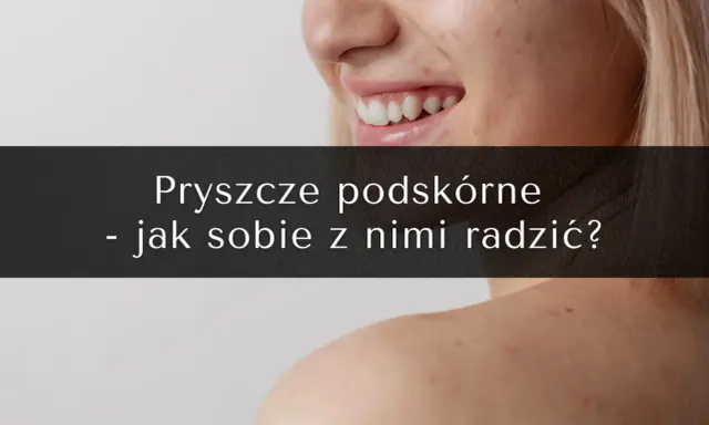 Pryszcze podskórne: Jak się ich pozbyć? Poradnik eksperta