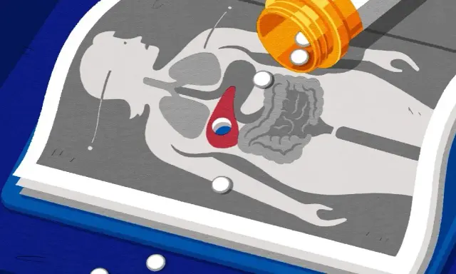 ¿Qué medicamentos dañan tu hígado? Guía para protegerte.