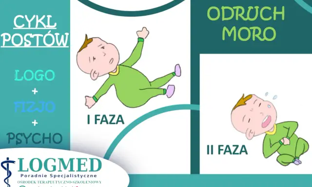 Ilustracja pokazuje odruch Moro do kiedy niemowlę reaguje na bodziec. Dwie fazy odruchu: I faza - rozłożenie rączek, II faza - przyciągnięcie rączek do siebie.