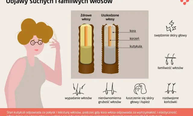 Ilustracja pokazuje porównanie zdrowych i uszkodzonych włosów, podkreślając łamliwość włosów i inne problemy.