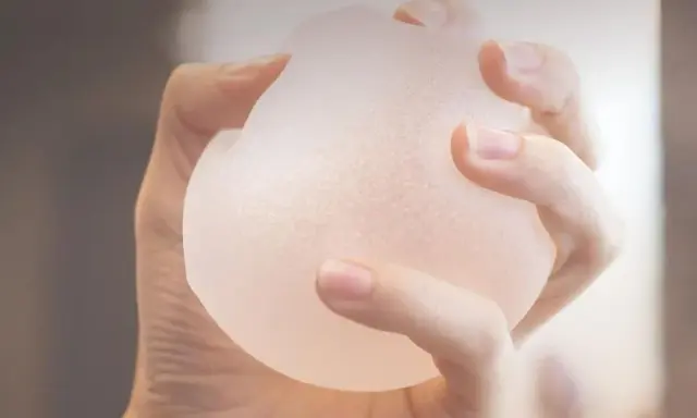 Mano che stringe una protesi b lite, un impianto leggero e traslucido per un aspetto naturale.