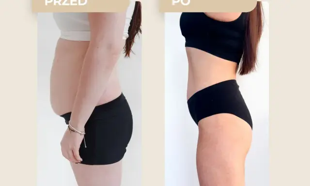Przed i po metamorfozie: widoczna zmiana sylwetki, która pokazuje, jak schudnąć 5 kg.