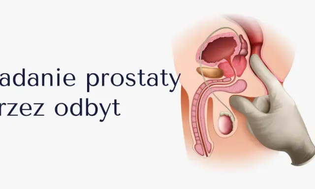 Ilustracja przedstawia badanie per rectum. Dłoń w rękawiczce bada prostatę, co może pomóc w diagnostyce problemów z zatrzymaniem moczu u mężczyzny.
