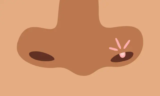 Gros plan sur un nez avec un bouton rose et des rayons de lumière.