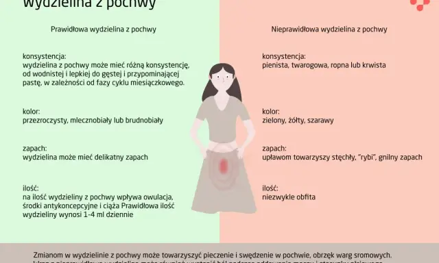 Nieprawidłowa wydzielina z pochwy, często poprzedzająca okres, może być pienista, mieć nieprzyjemny zapach i kolor.