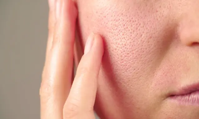 Gros plan sur la joue d'une personne, montrant les pores de la peau. Des doigts effleurent délicatement la surface.