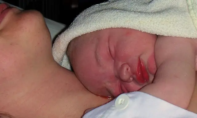 Nyfödd bebis med lite eksem på halsen, tätt intill mammas hud.