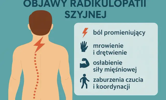Grafika ilustruje objawy radikulopatii szyjnej: piekący ból kręgosłupa szyjnego, mrowienie, osłabienie mięśni i zaburzenia koordynacji.