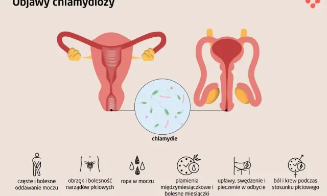 Ilustracja przedstawia układ rozrodczy kobiety i mężczyzny. U mężczyzn chlamydia może objawiać się bólem podczas oddawania moczu i stosunku.