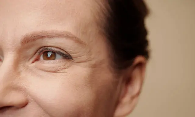 Primo piano dell'occhio di una donna con rughe evidenti, che suggeriscono un contorno occhi irritato o stanco.