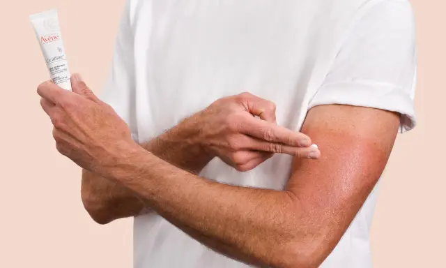 Un homme applique la crème Cicalfate+ sur son bras irrité, peut-être atteint de psoriasis, pour apaiser et réparer sa peau.