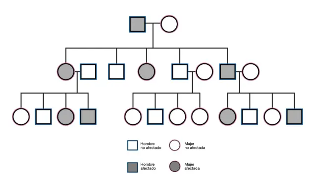 Árbol genealógico que muestra la herencia dominante. Individuos afectados (cuadrados y círculos grises) y no afectados (cuadrados y círculos blancos) a través de varias generaciones.