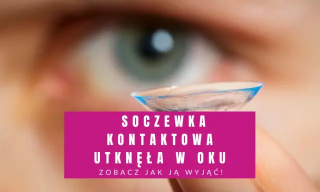 Nie mogę znaleźć soczewki w oku? Zobacz, jak wyjąć soczewkę kontaktową, która utknęła w oku.
