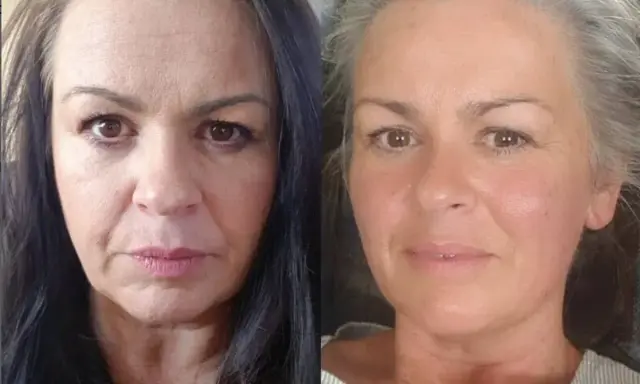 Avant/Après : une femme avant et après avoir pris du collagène. Sa peau semble plus lisse et radieuse.
