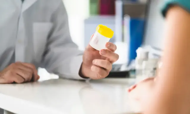 Lekarz podaje pacjentowi pojemnik na mocz, sugerując potrzebę diagnostyki w kierunku krwiomoczu, co jest pierwszym krokiem do ustalenia leczenia domowego.