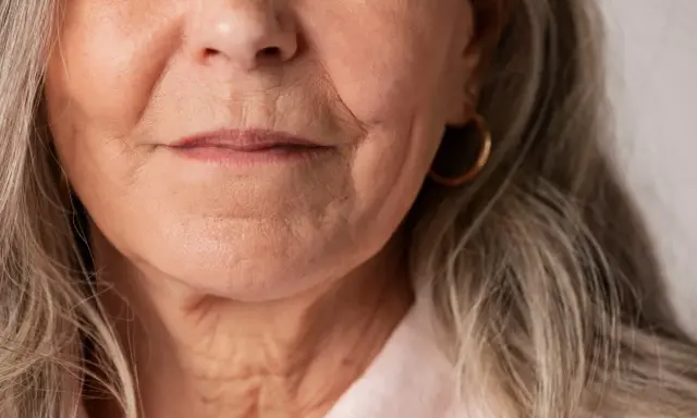 Gros plan sur le visage d'une femme âgée, montrant les rides autour de la bouche et du cou. Des conseils sur comment faire disparaître les rides profondes pourraient être utiles.