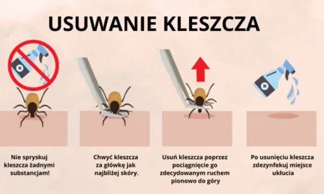 Kleszcz: Wyciągnij, nie wykręcaj! Prawidłowa instrukcja krok po kroku
