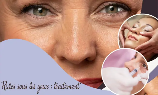 Traitement des rides sous les yeux : gros plan sur un visage, avec des images de soins esthétiques.