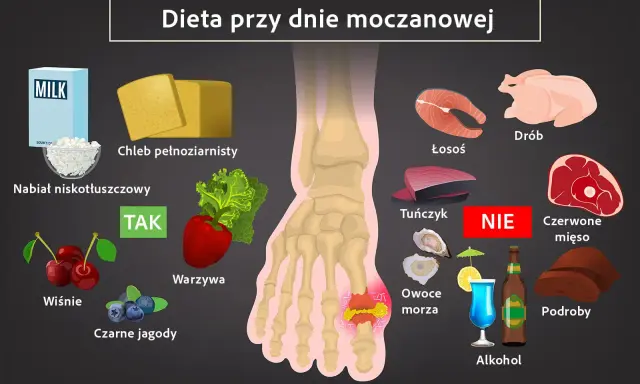 Dieta przy dnie moczanowej: TAK - nabiał, chleb, warzywa, wiśnie, jagody. NIE - drób, łosoś, tuńczyk, czerwone mięso, podroby, owoce morza, alkohol.