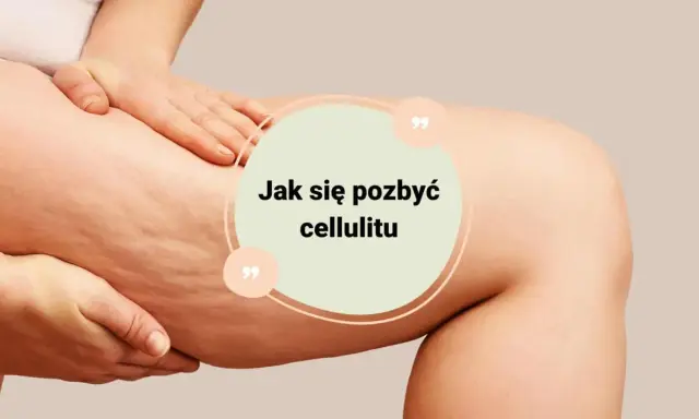 Jak pozbyłam się cellulitu? Mój 4-filarowy plan, który działa!