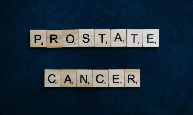 Litery z gry Scrabble układają napis "PROSTATE CANCER". Wiedza o objawach ostatniego stadium raka prostaty jest kluczowa.