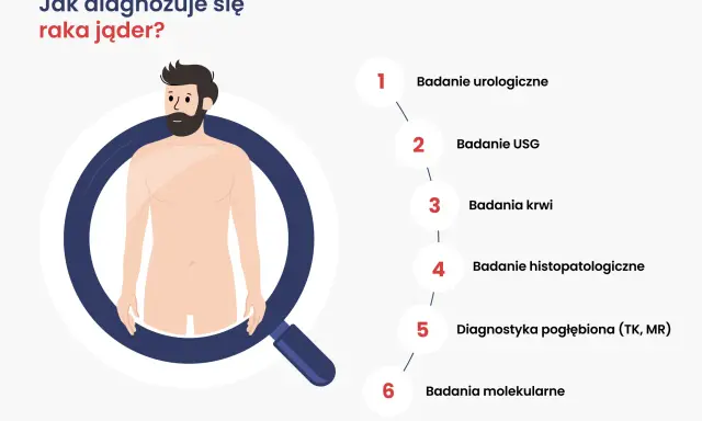 Ilustracja przedstawia schemat diagnozowania raka jąder. Wymienione badania to: urologiczne, USG, krwi, histopatologiczne, pogłębiona diagnostyka (TK, MR) i molekularne.