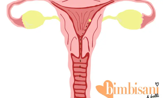 Illustrazione utero con ovuli gialli e macchie marroni, suggerendo spotting gravidanza colore.