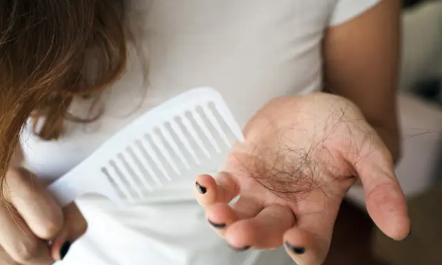 Frau hält Kamm und Haarbüschel in der Hand. Ein häufiges Problem: 4 Monate nach Geburt Haarausfall.