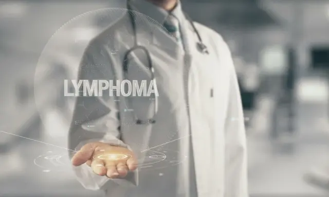 Lekarz prezentuje wirtualną kulę z napisem "LYMPHOMA", symbolizującą postęp w leczeniu chłoniaka grudkowego.