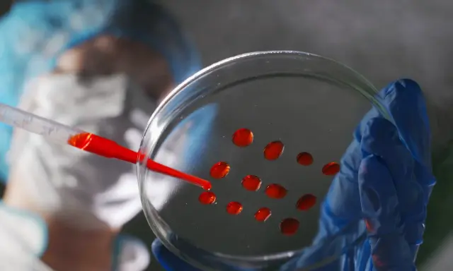Ricerca medica: gocce rosse su piastra di Petri, parte di un test per capire se hai un tumore.