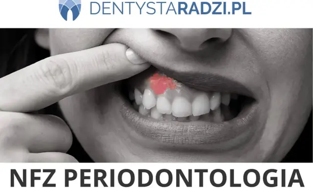 Zbliżenie na usta z widocznym zaczerwienieniem na dziąśle, sugerującym problem z paradontozą. Leczenie jest kluczowe.