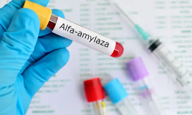 Amylaza podwyższona: co oznacza? Kiedy pilnie do lekarza?