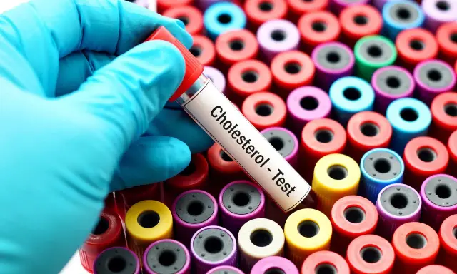 Rękawiczka trzyma probówkę "Cholesterol - Test" na tle wielu kolorowych probówek. Monakolina może wpływać na wyniki, warto to sprawdzić.