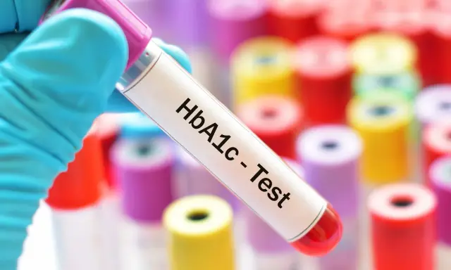 Rękawiczka trzyma probówkę z napisem "HbA1c - Test". W tle kolorowe probówki.
