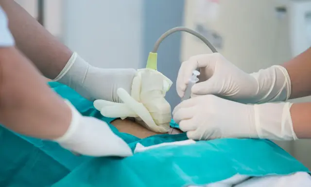 Lekarze w rękawiczkach wykonują amniopunkcję, badanie płynu owodniowego, które odpowiada na pytanie: amniopunkcja co to.