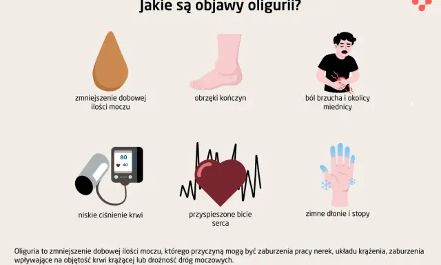 Objawy oligurii: zmniejszona ilość moczu, obrzęki, ból brzucha, niskie ciśnienie, przyspieszone bicie serca, zimne dłonie i stopy. Dużo piję, mało sikam.