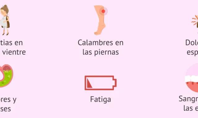 En el embarazo de 23 semanas, se muestran molestias comunes: dolor de vientre, calambres, dolor de espalda, ardores, fatiga y sangrado de encías.