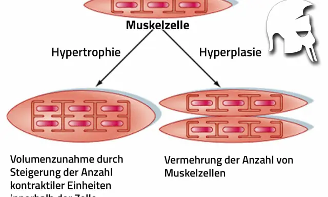 Sarkoplasmatische Hypertrophie: Muskelzelle wächst durch mehr kontraktile Einheiten. Daneben Hyperplasie: mehr Muskelzellen.