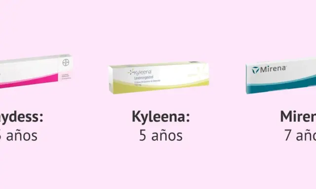 Jaydess, Kyleena y Mirena son métodos de planificación familiar, cada uno con una duración distinta. El diu hormonal ofrece diversas opciones.
