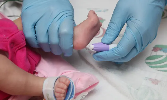 Screening neonatale dopo 15 giorni: un prelievo dal piedino per controlli essenziali.