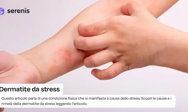Braccio con arrossamento e sfogo cutaneo, un dito che si gratta. Potrebbe essere dermatite da stress senza prurito.