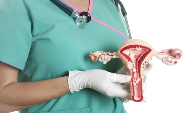 Model macicy z widocznymi mięśniakami. Lekarz w rękawiczkach pokazuje anatomiczny model, ilustrujący problem mięśniaków macicy.