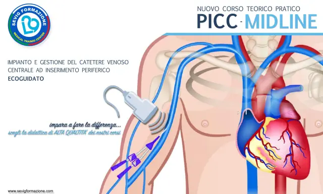 Corso pratico sull'inserimento PICC ecoguidato. Illustrazione anatomica mostra il posizionamento del catetere venoso centrale.