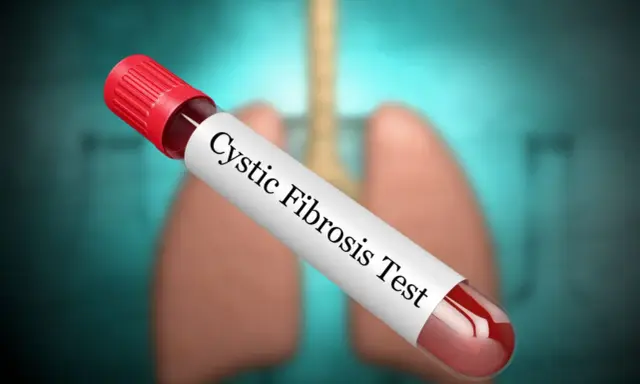 Provette con campione di sangue per il test della fibrosi cistica, con polmoni stilizzati sullo sfondo.