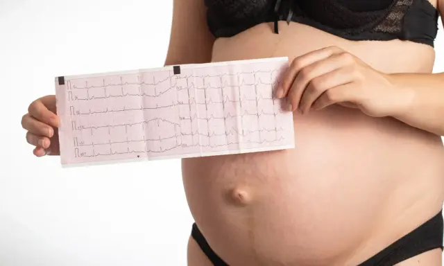 Pancia di donna incinta con elettrocardiogramma che mostra tachicardia. Monitoraggio cardiaco in gravidanza.