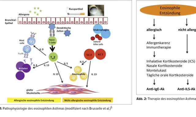 Schema zeigt eosinophile Entzündung bei Asthma: Allergene aktivieren Zellen, die zu TH2-Zellen und Eosinophilen führen. Abb. 2 zeigt Therapieansätze.