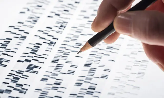 Dita che analizza un elettrofo gramma, uno strumento chiave nella biologia forense per identificare profili genetici.